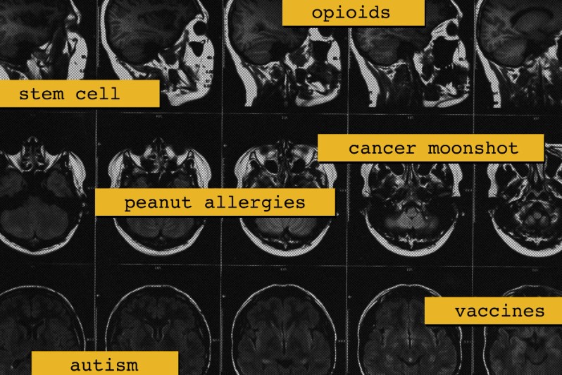 MRI images of human skull with words written over them