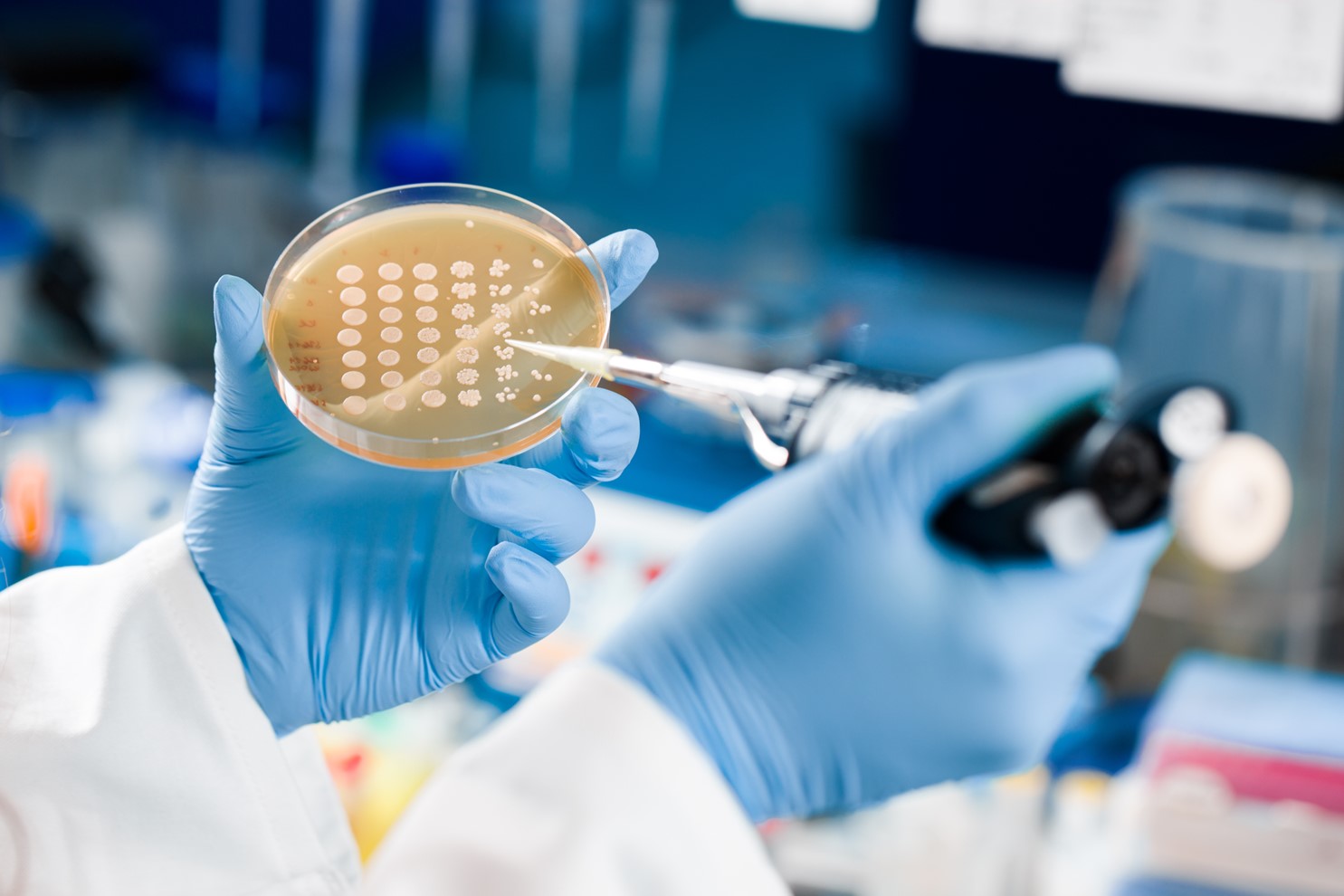 Yeast assay testing in wet lab