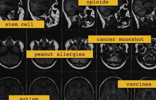 MRI images of human skull with words written over them