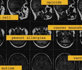 MRI images of human skull with words written over them